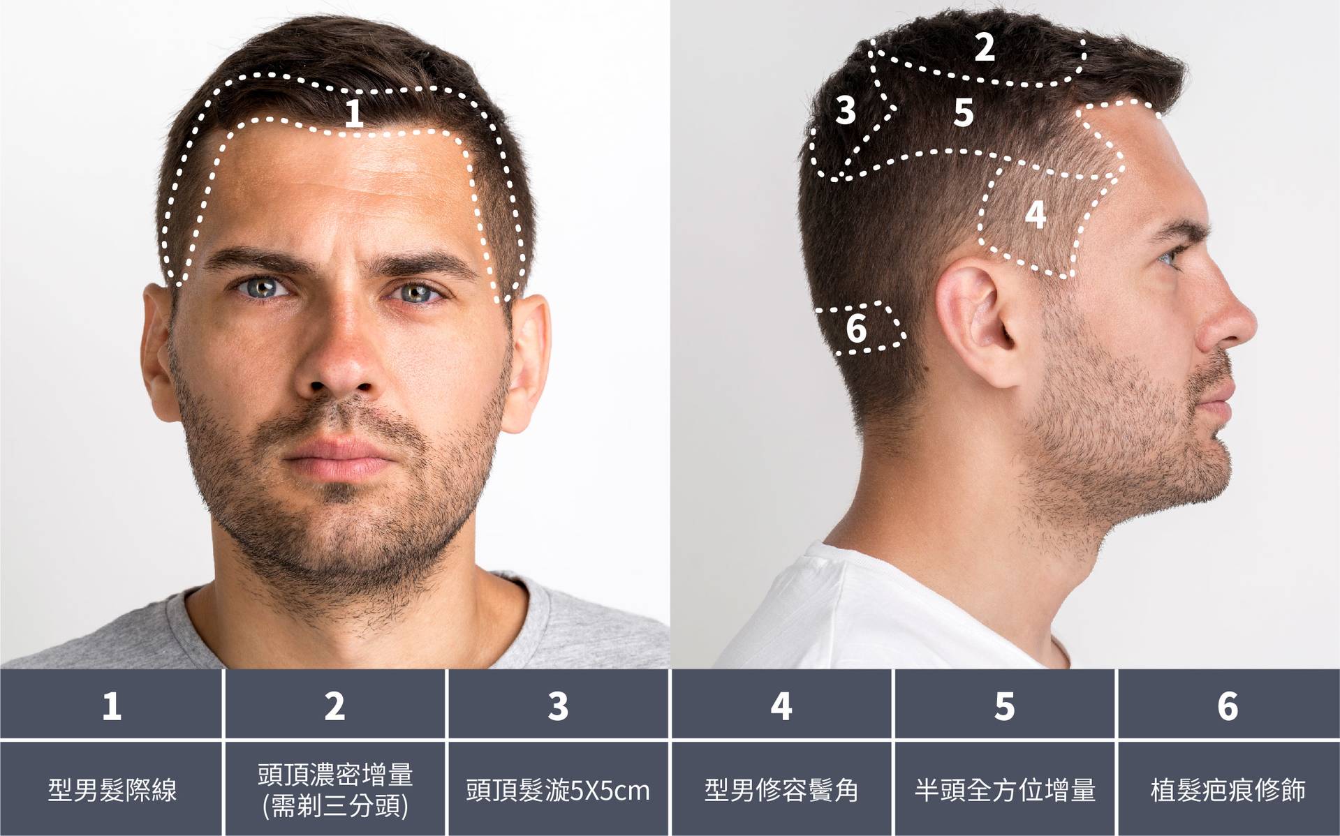 Jessie老師,魔術真髮,紋髮,繡髮,禿頭,掉髮,產後落髮,地中海禿頭,雄性禿,M型禿,植髮,假髮,假髮推薦,NPM,法泊藝學院