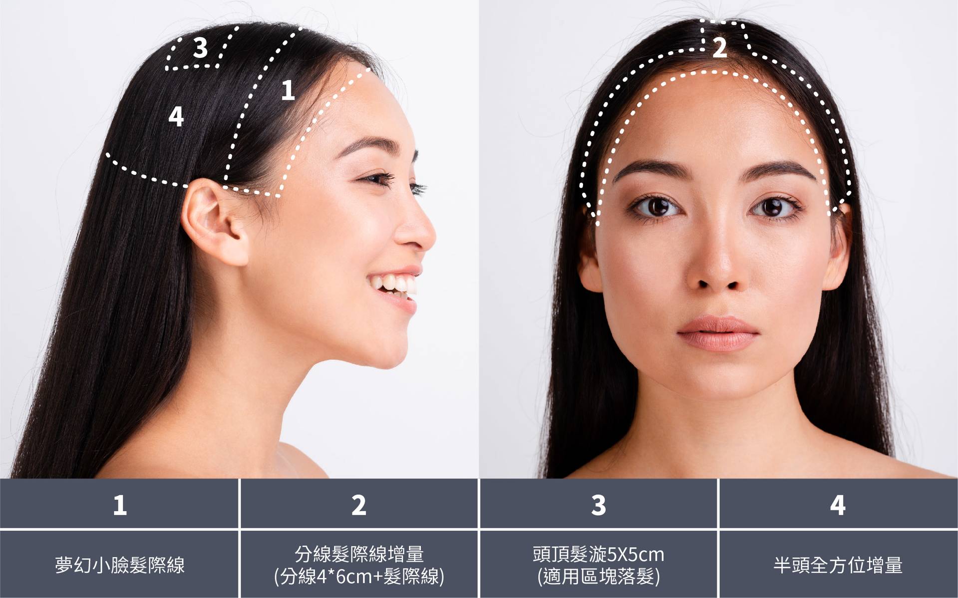 Jessie老師,魔術真髮,紋髮,繡髮,禿頭,掉髮,產後落髮,地中海禿頭,雄性禿,M型禿,植髮,假髮,假髮推薦,NPM,法泊藝學院