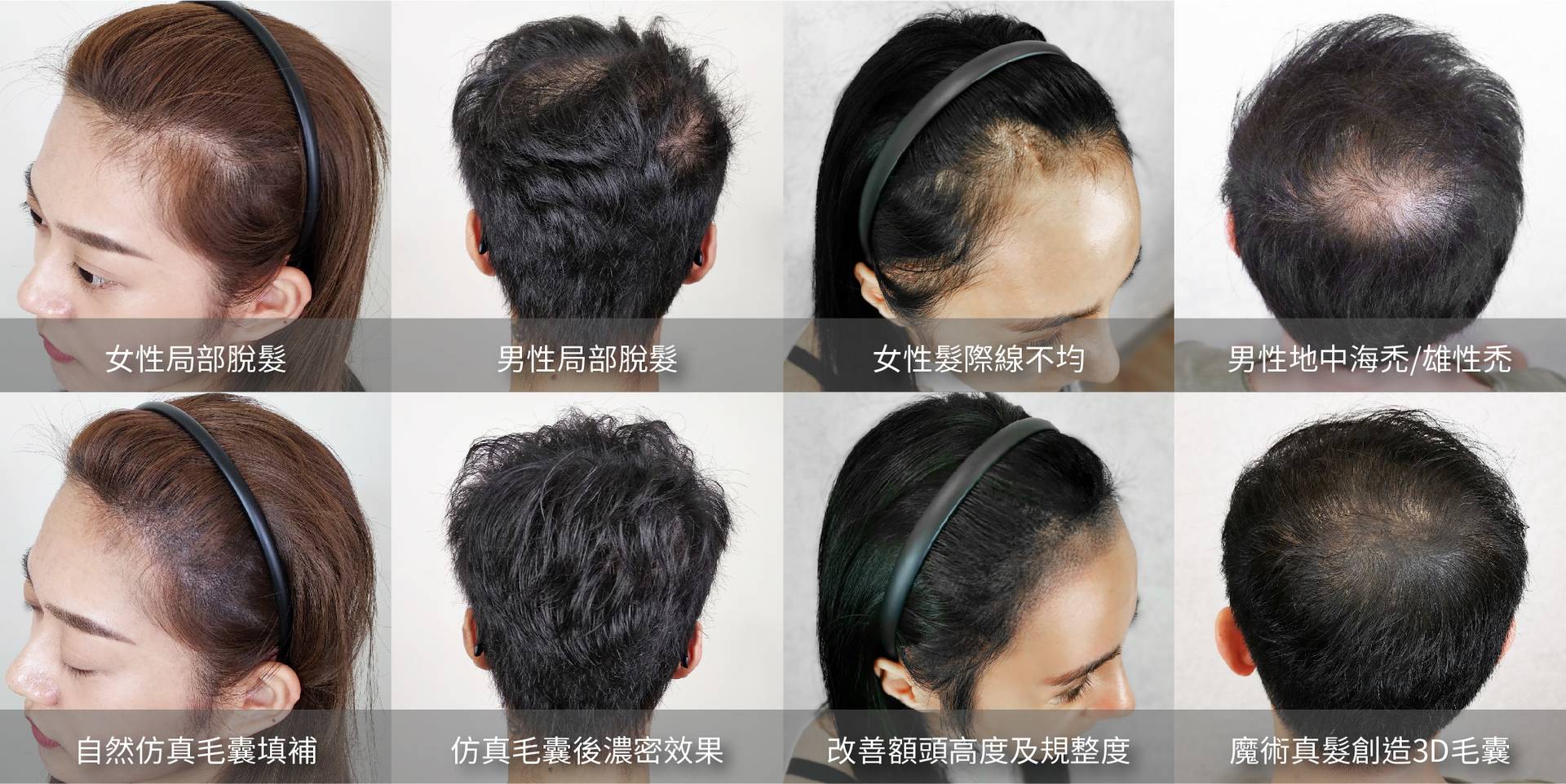 Jessie老師,魔術真髮,紋髮,繡髮,禿頭,掉髮,產後落髮,地中海禿頭,雄性禿,M型禿,植髮,假髮,假髮推薦,NPM,法泊藝學院